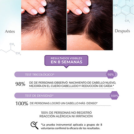 Anti-Hair Loss Spray Lotion