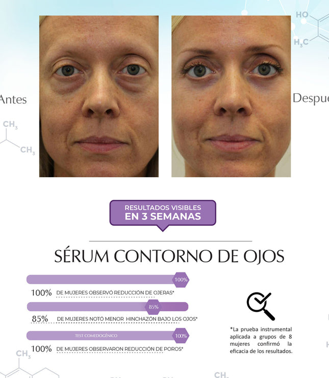 Sérum Contorno De Ojos - Hinchazón Y Ojeras, Dermatológico