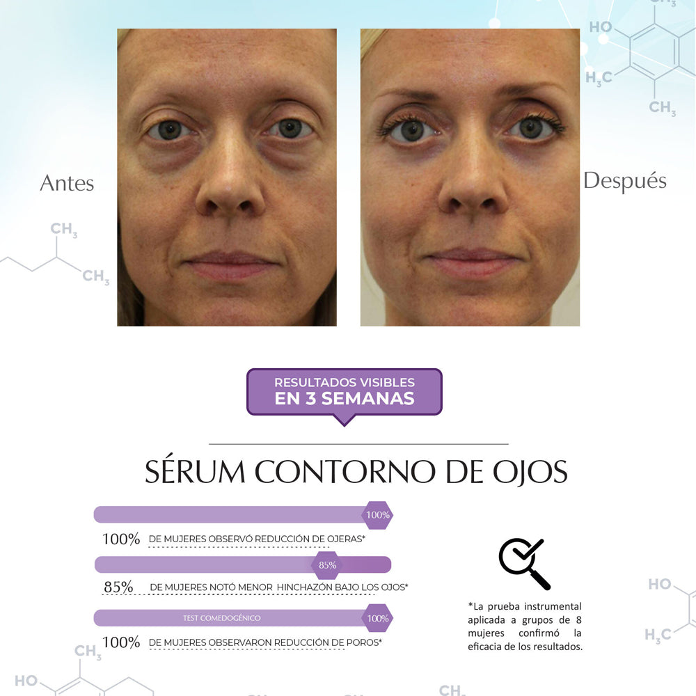 Sérum Contorno De Ojos - Hinchazón Y Ojeras, Dermatológico