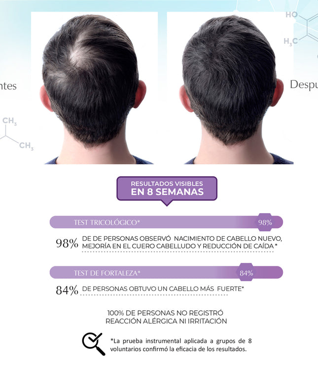 Shampoo Anticaída Regenerante