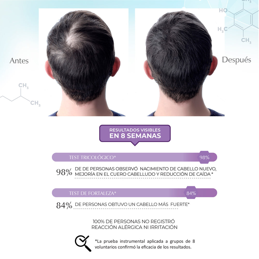 Shampoo Anticaída Regenerante